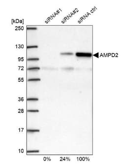 AMPD2 Antibody, Novus Biologicals 25 μL; Unlabeled:Antibodies, Polyclonal